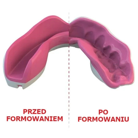 SafeJawz Ochraniacz szczęki Fangz Pink junior